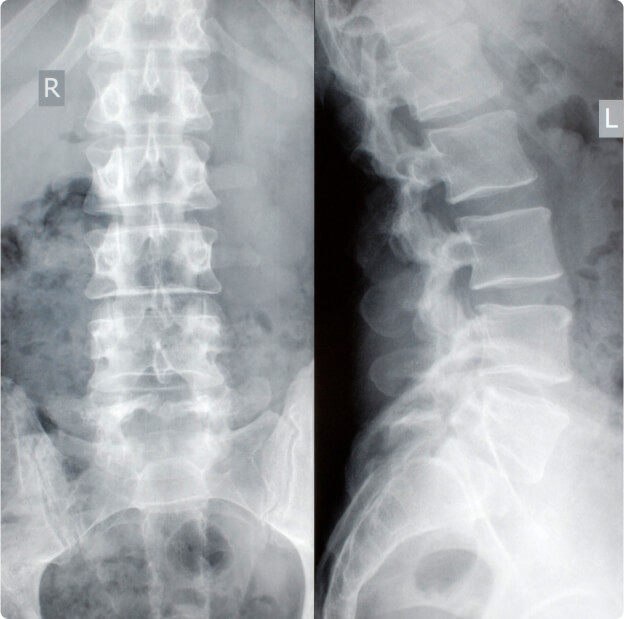 Neck Xray image